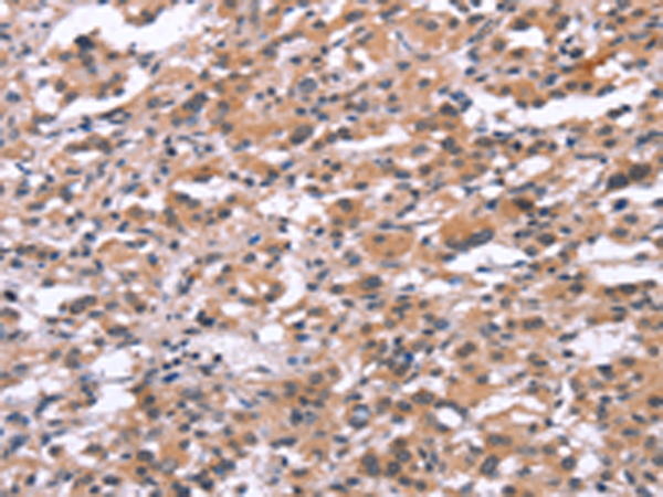 兔抗TUBGCP2多克隆抗体 
