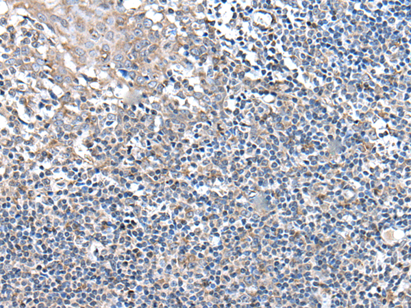 兔抗UBN2多克隆抗体 