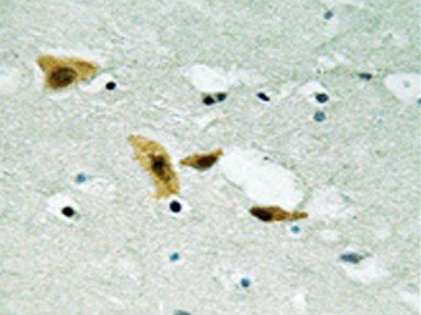 兔抗APLF(Ab-116)多克隆抗体