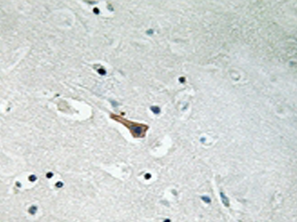 兔抗APLP2(Phospho-Tyr755)多克隆抗体