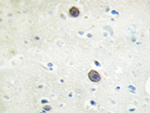 兔抗APP(Phospho-Thr743/668) 多克隆抗体