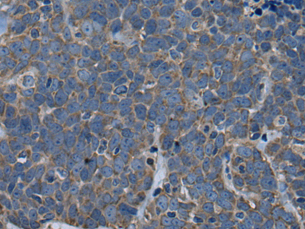 兔抗ARFGEF1多克隆抗体
