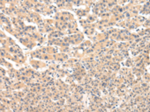 兔抗VPS33B多克隆抗体 
