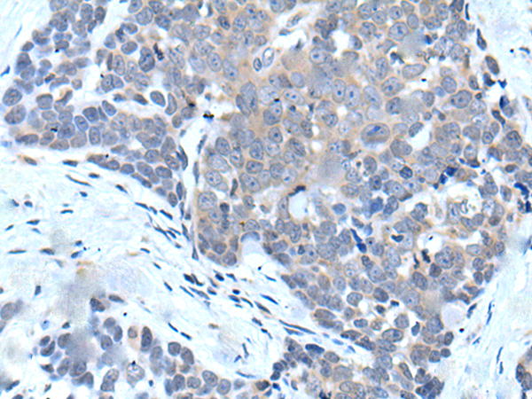 兔抗VPS35多克隆抗体 