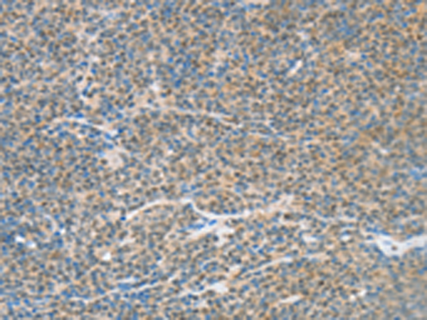 兔抗ATF2多克隆抗体