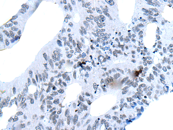 兔抗BCL6多克隆抗体