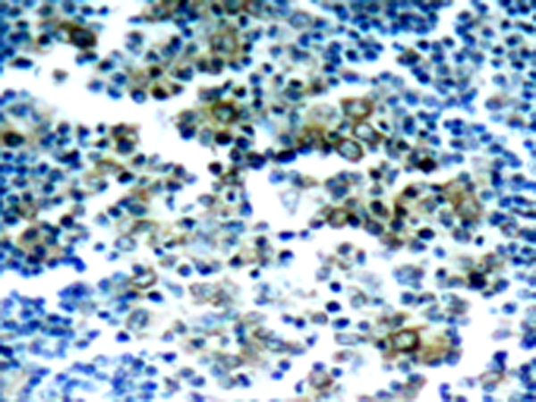兔抗BCR (Phospho-Tyr177)多克隆抗体