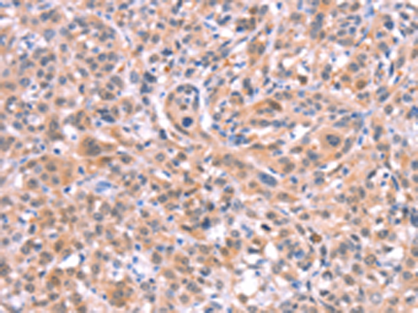 兔抗BMPR2多克隆抗体