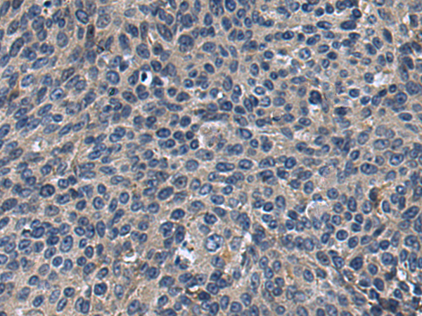 兔抗BTN1A1多克隆抗体