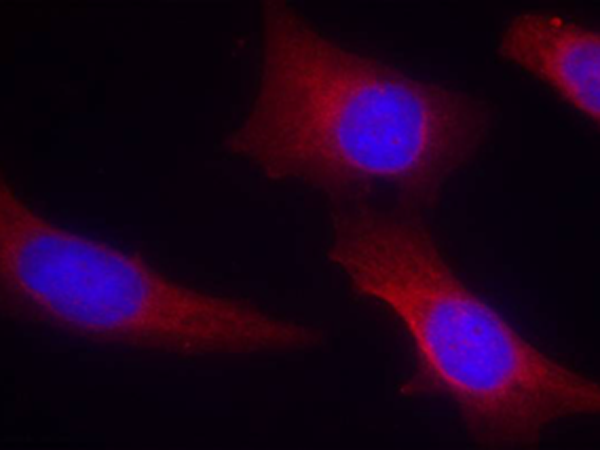 兔抗CAMK2A(Ab-286)多克隆抗体