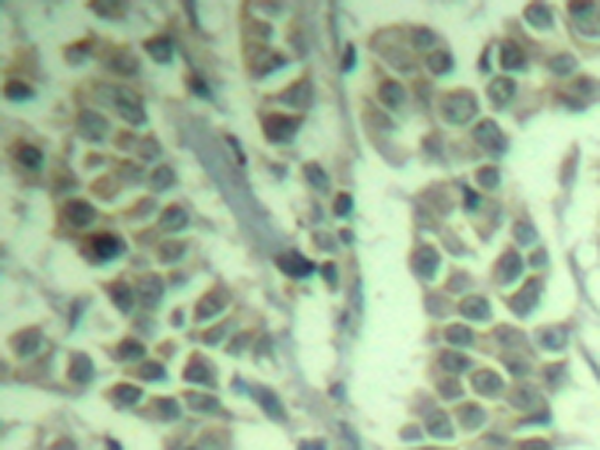 兔抗CBL (phospho-Tyr700)多克隆抗体