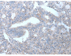 兔抗WFDC12多克隆抗体  