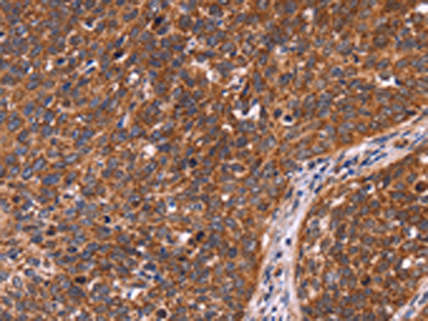 兔抗CCDC106多克隆抗体