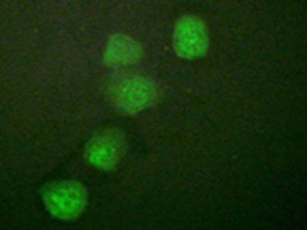 兔抗CCNE1(Ab-395)多克隆抗体