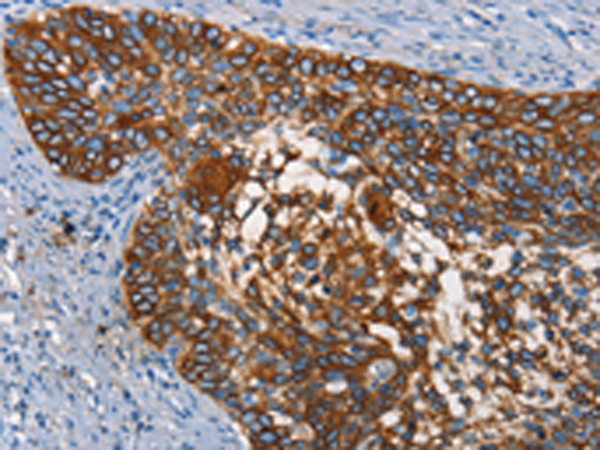 兔抗CD68多克隆抗体