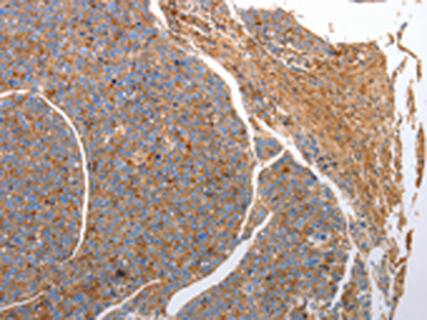 兔抗CD151多克隆抗体