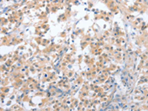 兔抗CD200R1多克隆抗体