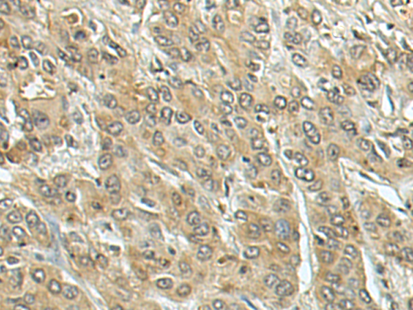 兔抗CD207多克隆抗体