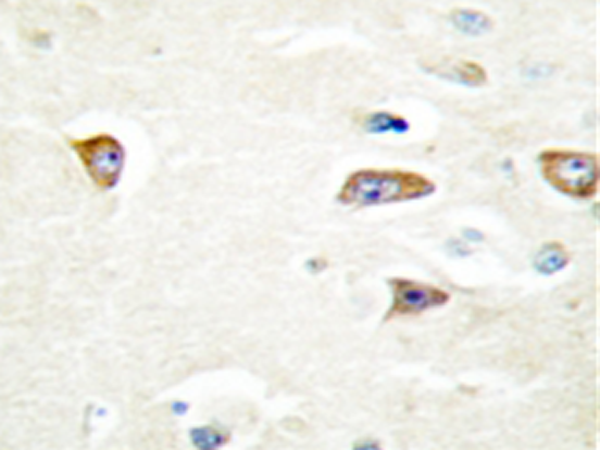 兔抗CDC42BPB多克隆抗体