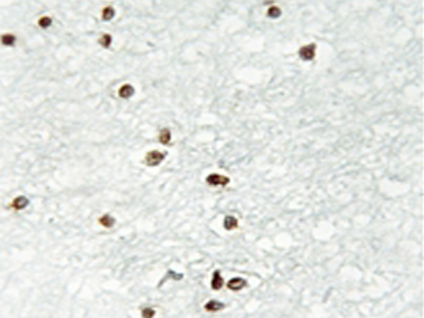 兔抗ZIC1/2/3多克隆抗体