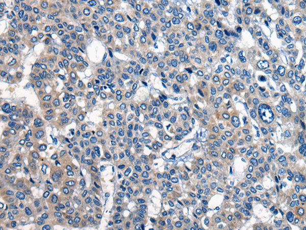 兔抗CDH17多克隆抗体