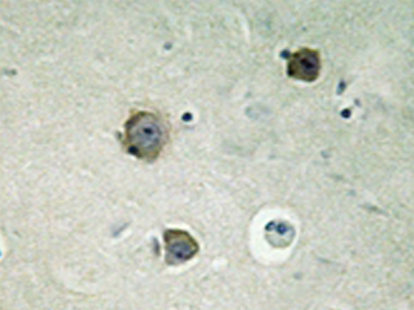 兔抗CDK5(Ab-15)多克隆抗体