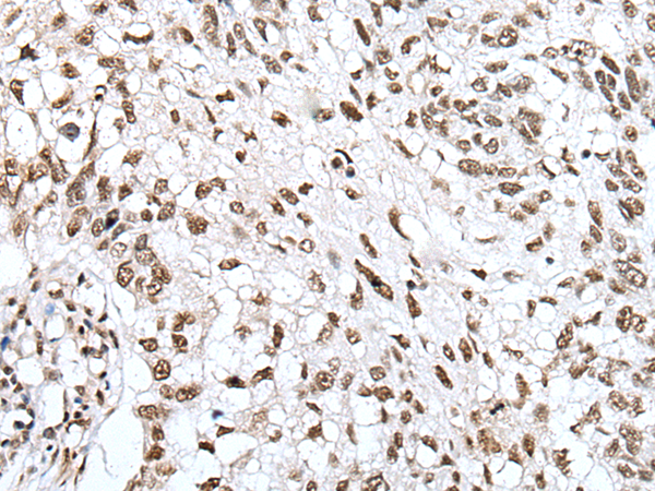 兔抗ZNF43多克隆抗体