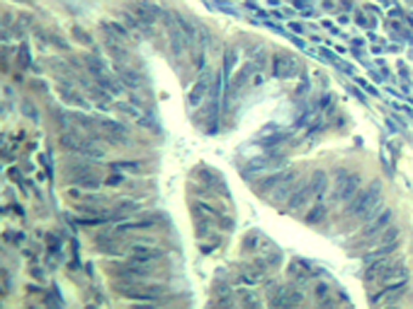 兔抗CDK6 (phospho-Tyr24)多克隆抗体