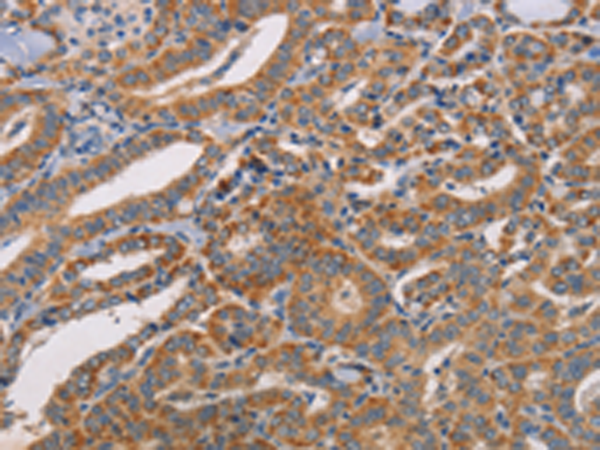 兔抗CDK11A/CDK11B多克隆抗体