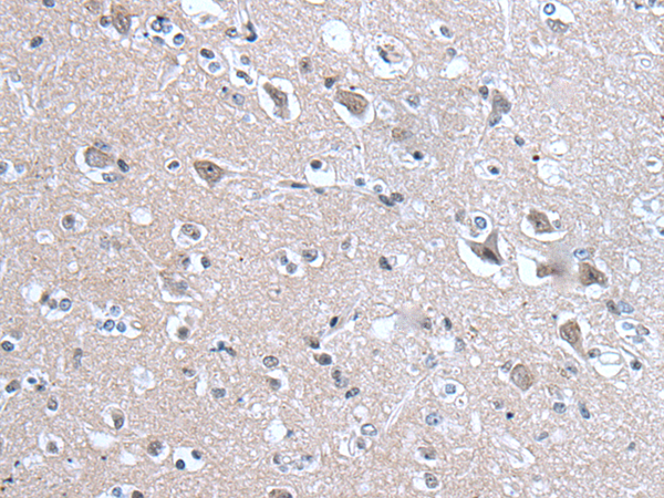 兔抗ZNF143多克隆抗体 