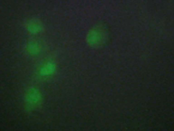 兔抗ZNF174多克隆抗体 