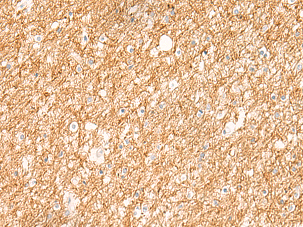 兔抗ZNF185多克隆抗体
