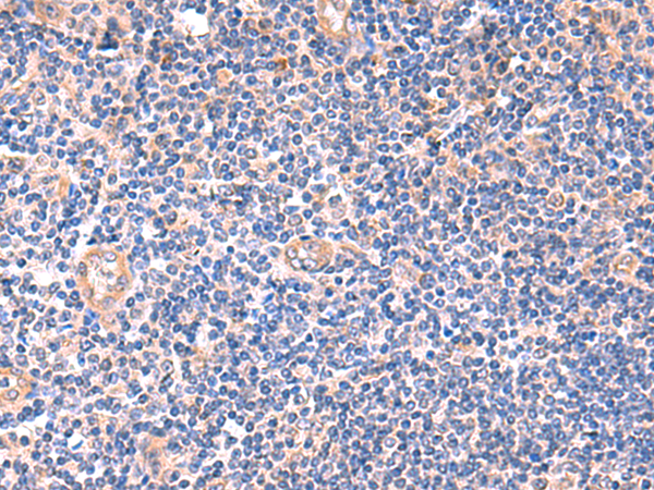 兔抗ZNF256多克隆抗体 