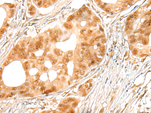 兔抗CDKN2AIPNL多克隆抗体