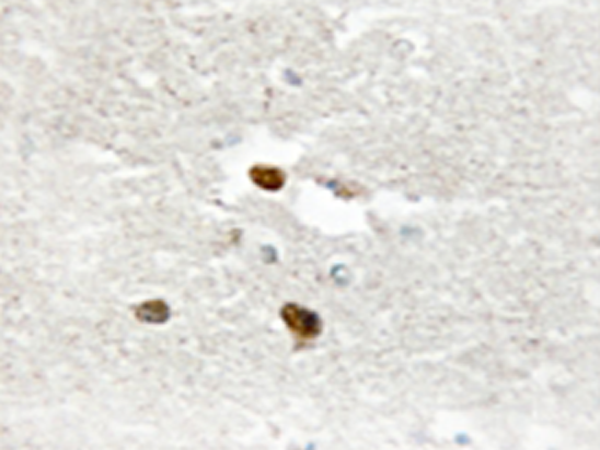 兔抗ZNF287多克隆抗体   
