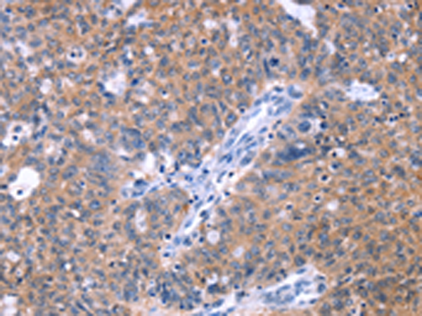 兔抗ZNF395多克隆抗体 
