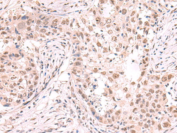 兔抗ZNF559多克隆抗体 