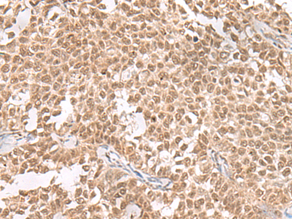 兔抗ZNF560多克隆抗体 