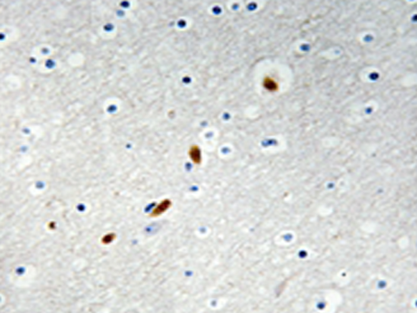 兔抗ZNF596多克隆抗体   