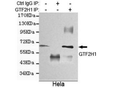 小鼠抗GTF2H1单克隆抗体  