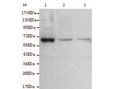 小鼠抗GTF2H1单克隆抗体  