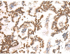 小鼠抗HSPB1单克隆抗体  