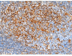 小鼠抗HSPB1单克隆抗体  