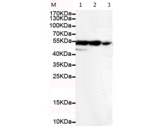 小鼠抗KRT7(C-term)单克隆抗体 