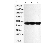 小鼠抗KRT18单克隆抗体