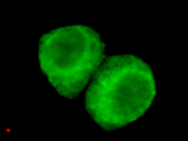 小鼠抗JMJD6(N-term)单克隆抗体