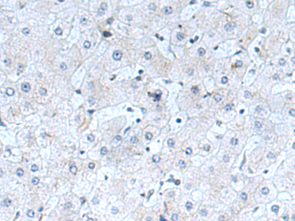 小鼠抗MICU1单克隆抗体