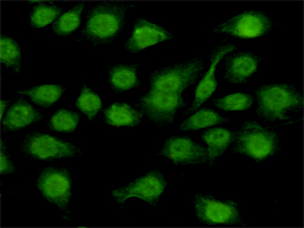 小鼠抗NFIC单克隆抗体   