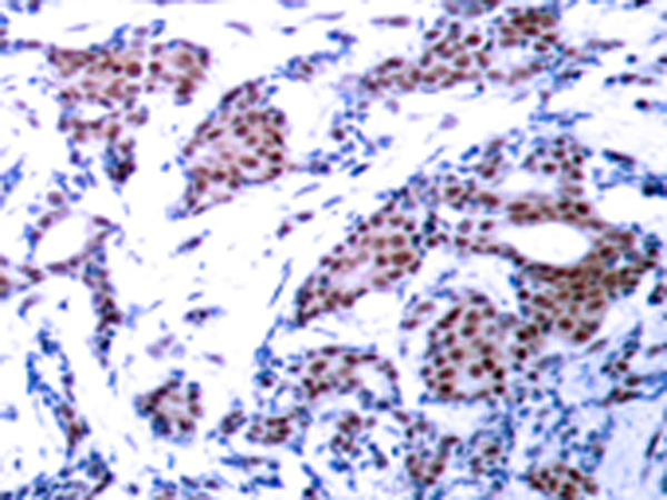 兔抗JUN (Phospho-Ser73)多克隆抗体 