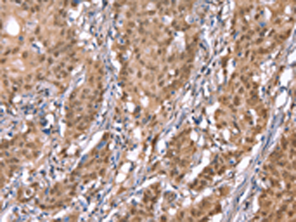 兔抗KCNJ6多克隆抗体